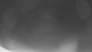Archived webcam image showing Weißer Stein in der Eifel on 18 May 2026 at 04:00
