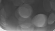 Archived webcam image showing Weißer Stein in der Eifel on 18 May 2026 at 02:00