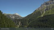 Archived webcam image showing Lech Zürs (Arlberg) - Zugerberg Gondola on 19 Aug 2026 at 15:29