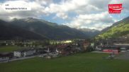 Archiviertes Webcam Bild: Wildkogel-Arena: Bergstation Frühmesserbahn 2150m am 04.07.2026 um 08:43 Uhr