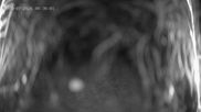 Archived webcam image showing Ladurns: Top Station Wastenegg on 28 Jul 2026 at 00:13
