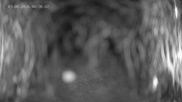 Archived webcam image showing Ladurns: Top Station Wastenegg on 3 Aug 2026 at 00:11