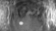 Archived webcam image showing Ladurns: Top Station Wastenegg on 13 Sep 2026 at 00:28