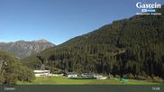 Archived webcam image showing Angertal Ski Centre on 15 Oct 2026 at 15:30