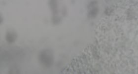 Rudnigsattel - Nassfeld Ski Resort